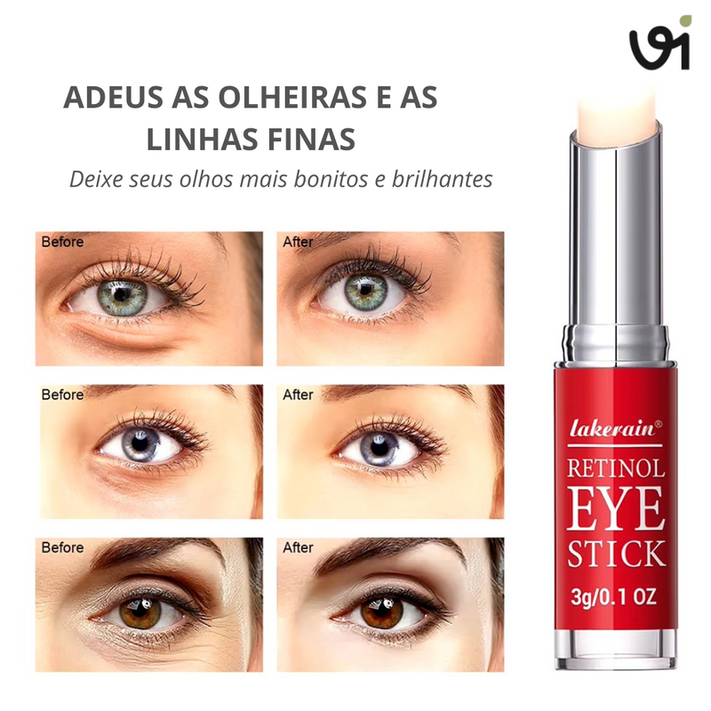 Bastão Retinol Anti Rugas Vitta